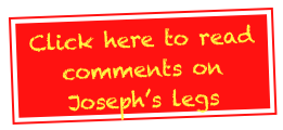 Click here to read comments on Joseph’s legs